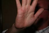 dakkus left his imprints on giberski's hand